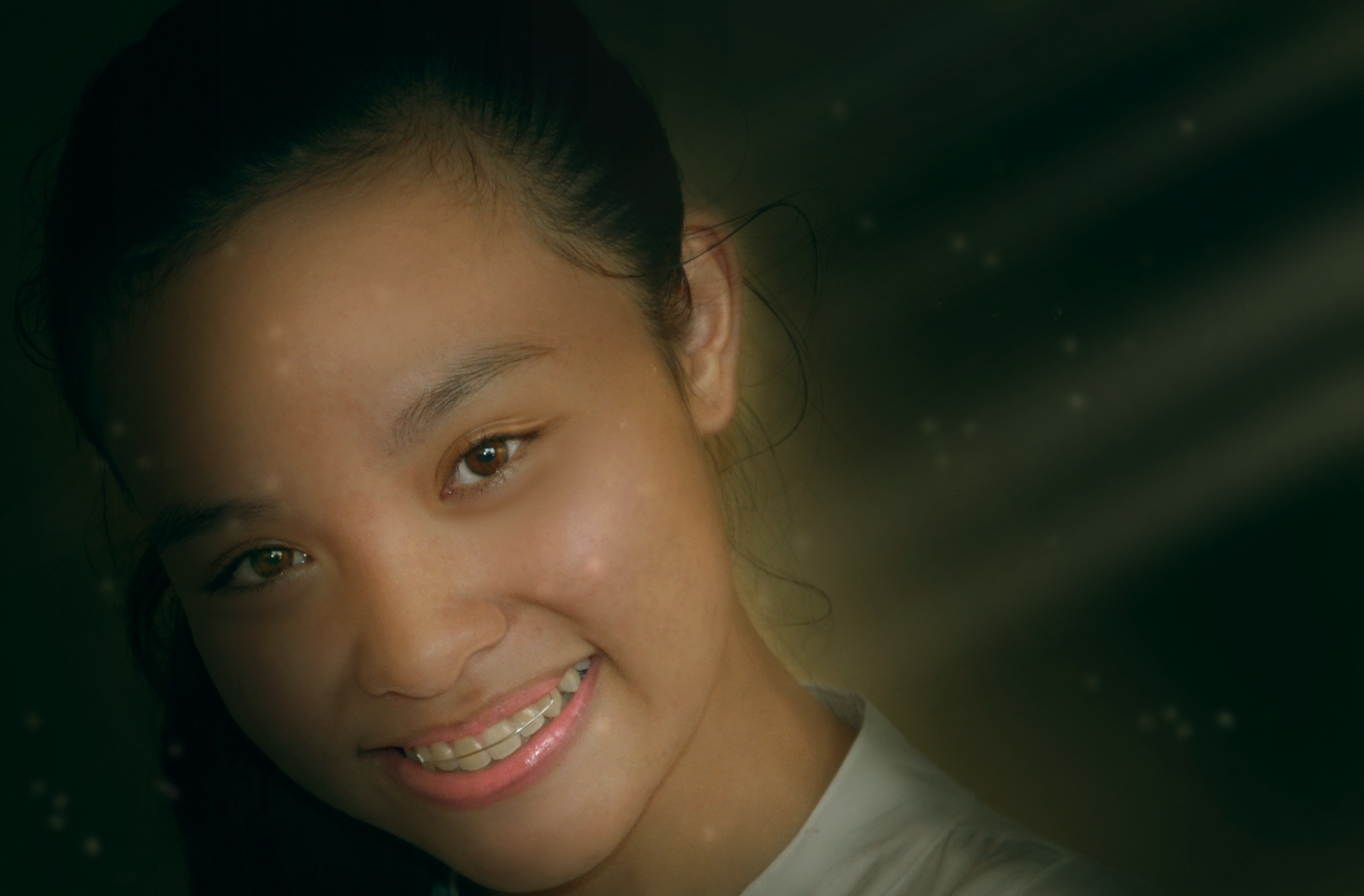 Clear Aligners Orthodontics 