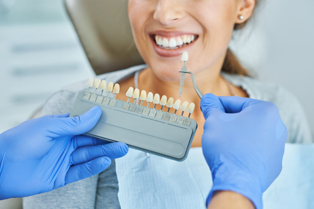 Dental Bridges